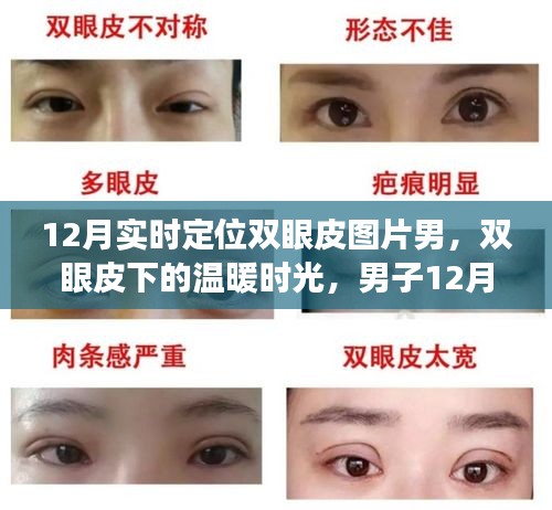 男子雙眼皮恢復(fù)之旅，冬季溫暖時光與友情的碰撞