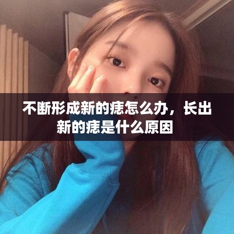 不斷形成新的痣怎么辦，長(zhǎng)出新的痣是什么原因 