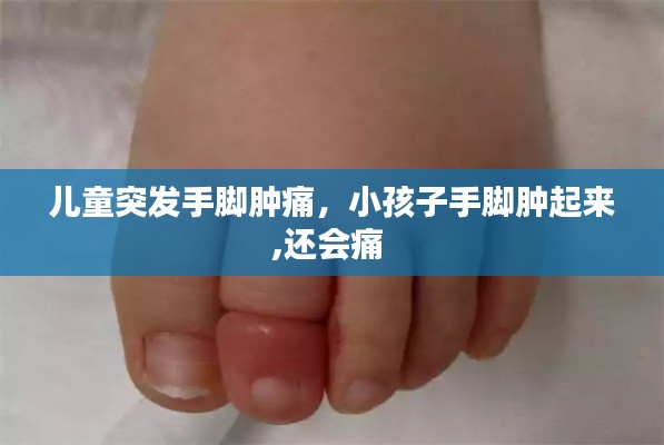 兒童突發(fā)手腳腫痛，小孩子手腳腫起來,還會痛 