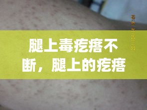 腿上毒疙瘩不斷，腿上的疙瘩特別特別多為什么 