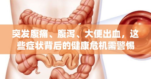 突發(fā)腹痛、腹瀉、大便出血，這些癥狀背后的健康危機需警惕！