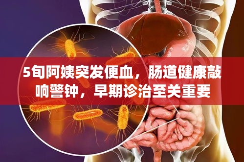 5旬阿姨突發(fā)便血，腸道健康敲響警鐘，早期診治至關(guān)重要