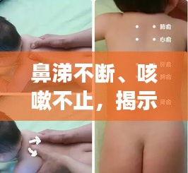 鼻涕不斷、咳嗽不止，揭示癥狀背后的健康隱患