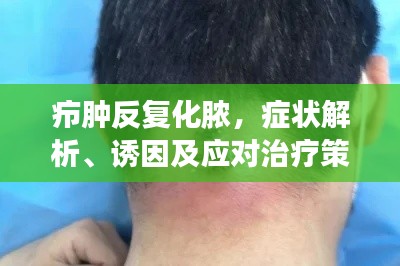 癤腫反復(fù)化膿，癥狀解析、誘因及應(yīng)對(duì)治療策略